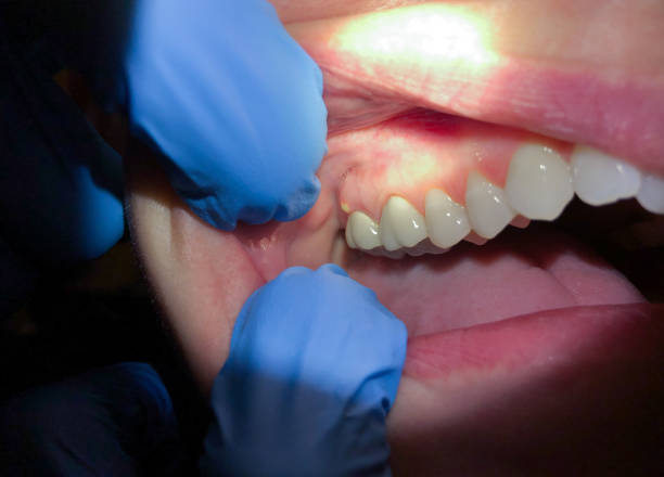 Best Emergency Orthodontic Repairs in Kirbyville, TX